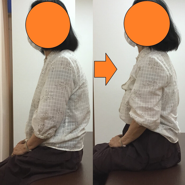 画像314